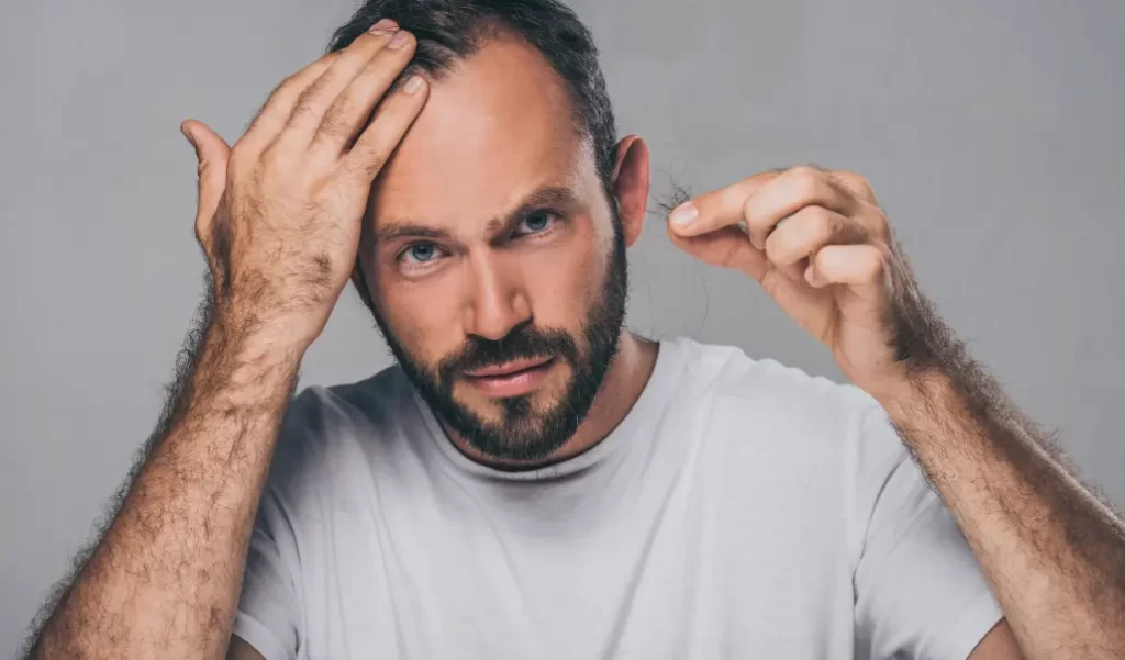 Hair Loss After Weight Loss: What’s Really Happening?